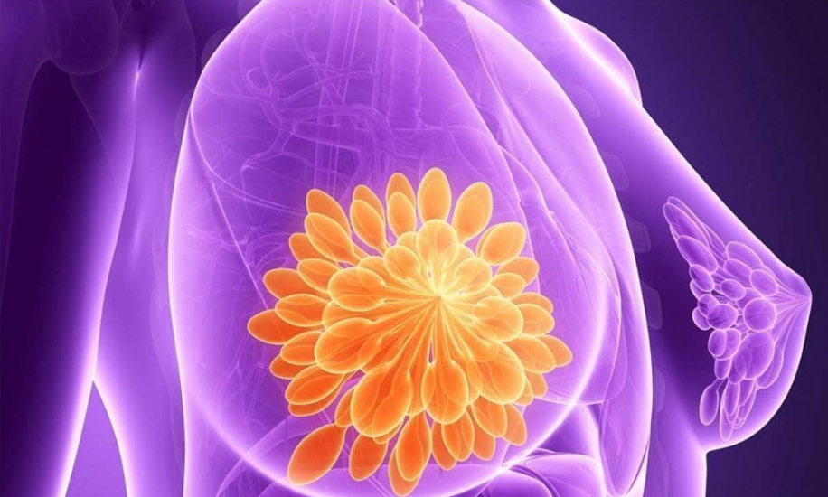 有乳腺增生怎么調(diào)理 得乳腺增生的原因是什么