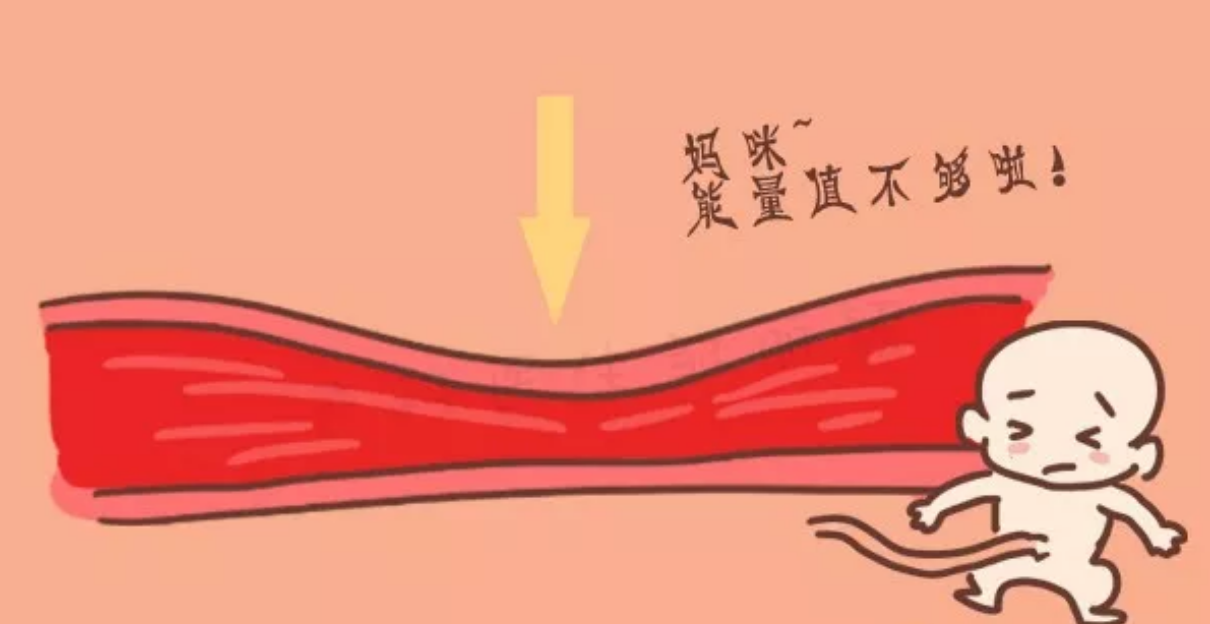 孕婦可以穿高跟鞋嗎 如何挑選孕婦鞋