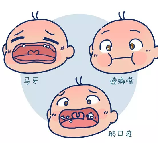 需要給新生寶寶清洗口腔嗎 新生寶寶每天口腔都要清理嗎2018