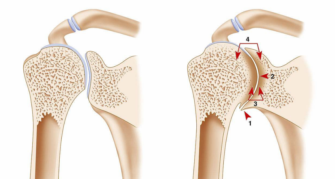 血友病隱性遺傳還是顯性遺傳 血友病能治好嗎