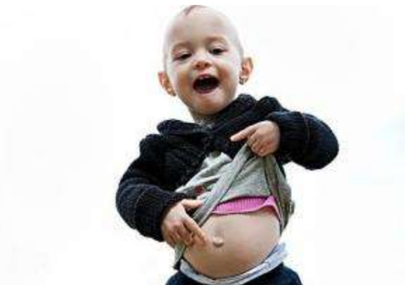 3歲寶寶喜歡摳肚臍眼怎么辦 寶寶喜歡摳肚臍眼是什么原因 3歲寶寶喜歡摳肚臍眼怎么辦 寶寶喜歡摳肚臍眼是什么原因