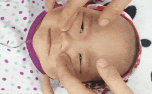 寶寶流鼻涕按摩哪里好 小孩流鼻涕推拿手法