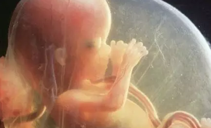 胎停育一般發生在什么時候2018 B超怎么看是不是胎停育