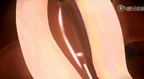 稽留流產后備孕做哪些2019 胎停稽留流產后生男寶經驗