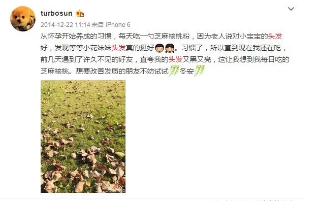 產后脫發嚴重是怎么回事 產后脫發會持續多久