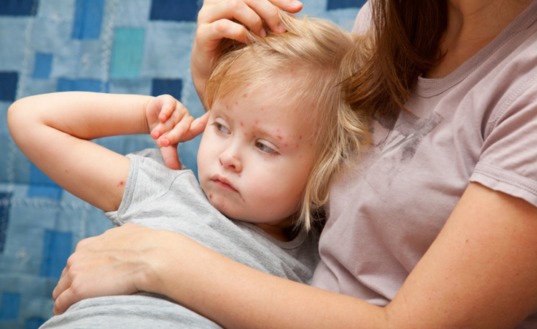 寶寶被蟲咬了起水泡怎么辦 2018夏季寶寶蟲咬皮炎如何處理