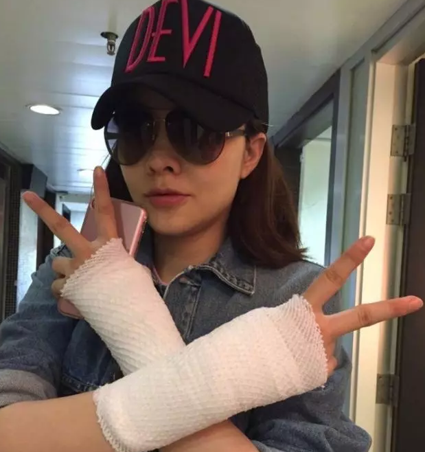 熊黛林媽媽手是什么 媽媽手怎么治療2018 熊黛林媽媽手是什么 媽媽手怎么治療2018