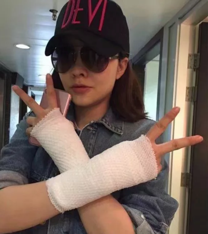 哪些習慣容易患媽媽手 媽媽手腱鞘炎怎么治療 