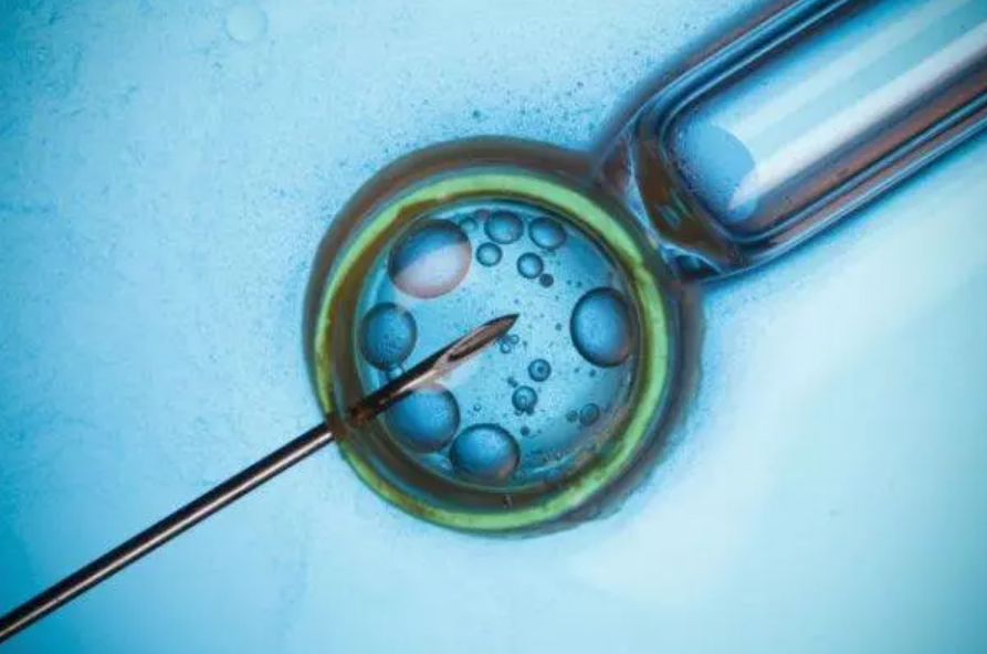 跳繩能疏通輸卵管嗎 輸卵管堵塞能疏通嗎