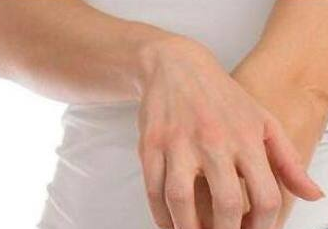 蕁麻疹不吃藥可以自己好嗎 起蕁麻疹用什么藥好