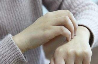 蕁麻疹驗血有什么作用 蕁麻疹抽血檢查要注意些什么