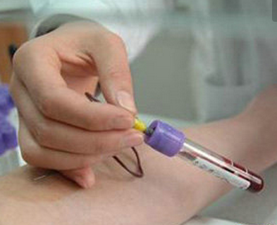 蕁麻疹驗血有什么作用 蕁麻疹抽血檢查要注意些什么