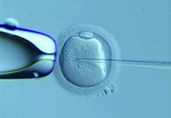 什么季節(jié)做試管嬰兒最好 做試管嬰兒要考慮哪些問題