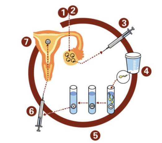 夏季做試管嬰兒最好真的嗎2018 試管嬰兒的妊娠率和季節有關系嗎