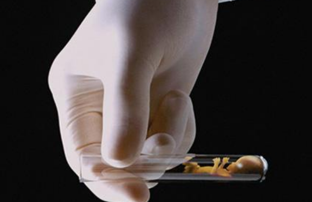 試管嬰兒過度刺激綜合征怎么辦 過度刺激綜合征有哪些影響