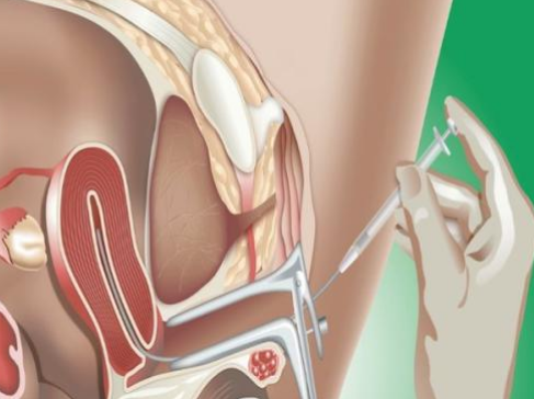 子宮很小能做試管嬰兒嗎2018 卵巢不排卵能不能做試管嬰兒 子宮很小能做試管嬰兒嗎2018 卵巢不排卵能不能做試管嬰兒