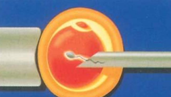 子宮很小能做試管嬰兒嗎2018 卵巢不排卵能不能做試管嬰兒 子宮很小能做試管嬰兒嗎2018 卵巢不排卵能不能做試管嬰兒