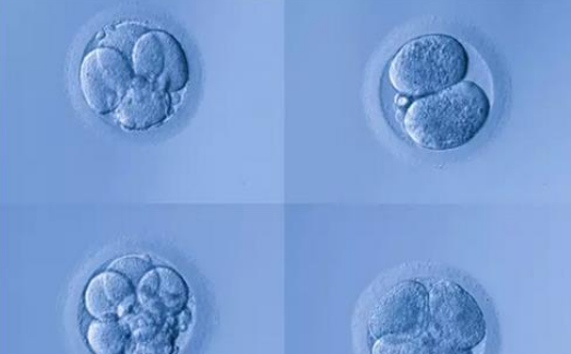 做試管嬰兒前男方要做什么 哪種情況下合適做試管嬰兒 做試管嬰兒前男方要做什么 哪種情況下合適做試管嬰兒