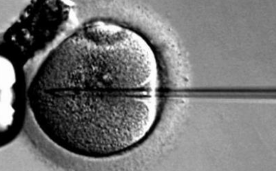 取卵全麻手術(shù)時間多長2018 取卵手術(shù)之后要注意哪些