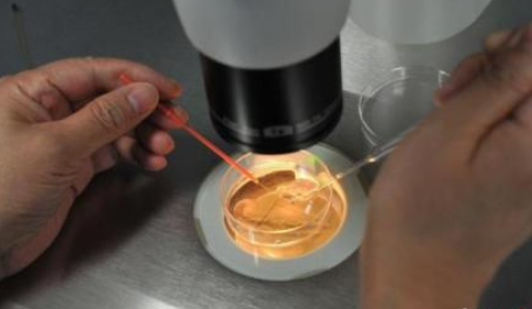 取卵全麻手術(shù)時間多長2018 取卵手術(shù)之后要注意哪些