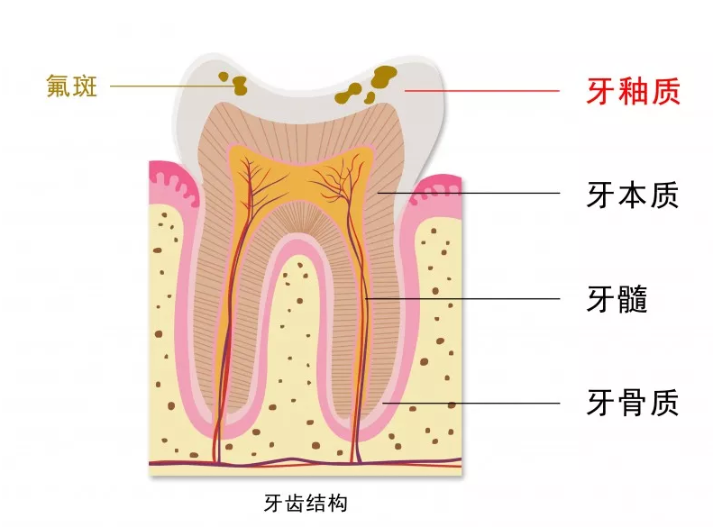 孩子刷牙齒不能用含氟牙膏嗎 孩子用含氟牙膏會變成氟斑牙嗎