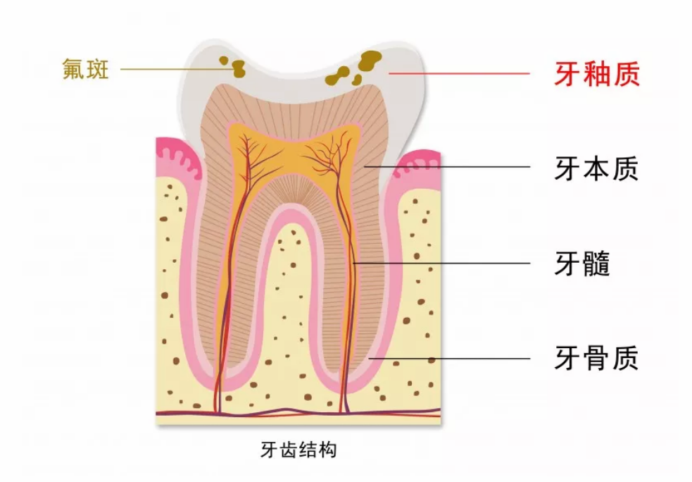 孩子用含氟牙膏會導致氟斑牙嗎 3歲以下的孩子有必要用含氟牙膏嗎