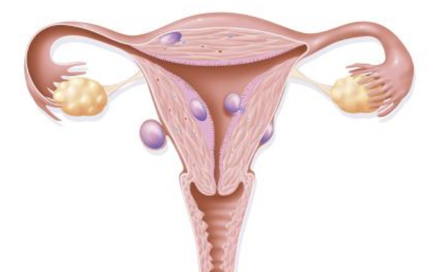 試管嬰兒移植后腹脹胸悶怎么辦 試管嬰兒移植后緩解腹脹胸悶方法