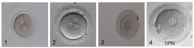 移植異常胚胎可發育為健康嬰兒嗎 
