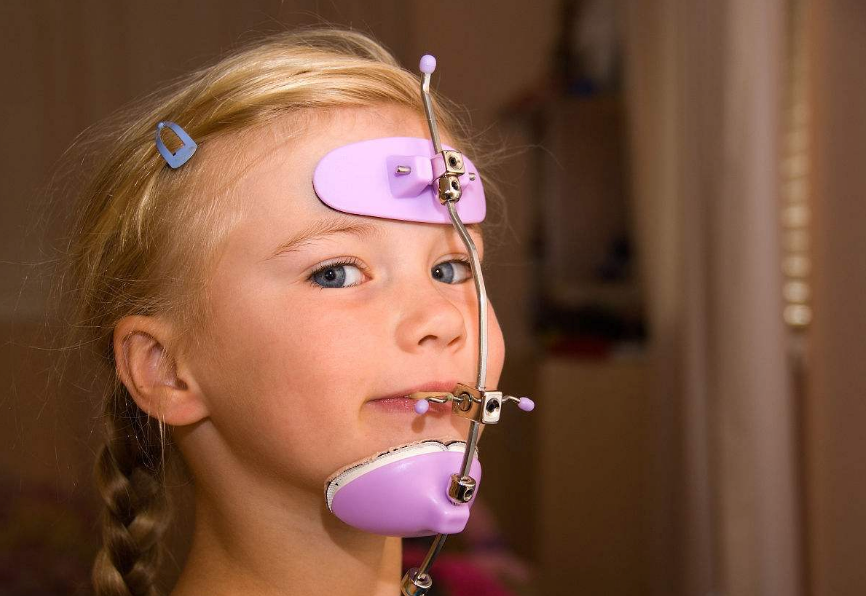 孩子牙亂咬合不正會影響發育嗎 如何治療寶寶牙亂咬合不正 孩子牙亂咬合不正會影響發育嗎 如何治療寶寶牙亂咬合不正