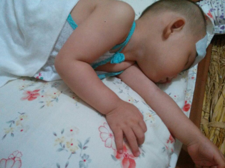 孩子夏天特別容易長痱子怎么辦 2018預防孩子長痱子方法