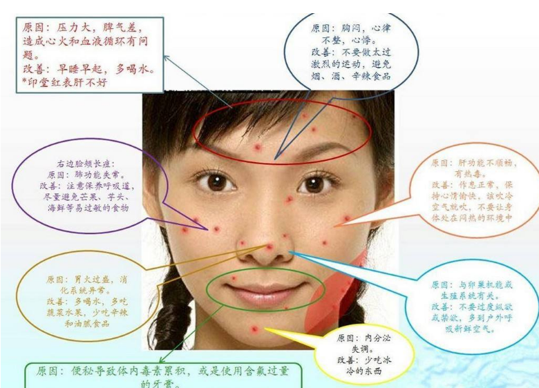 長痘印之后怎么去痘印 淡化痘印有什么方法2018 長痘印之后怎么去痘印 淡化痘印有什么方法2018