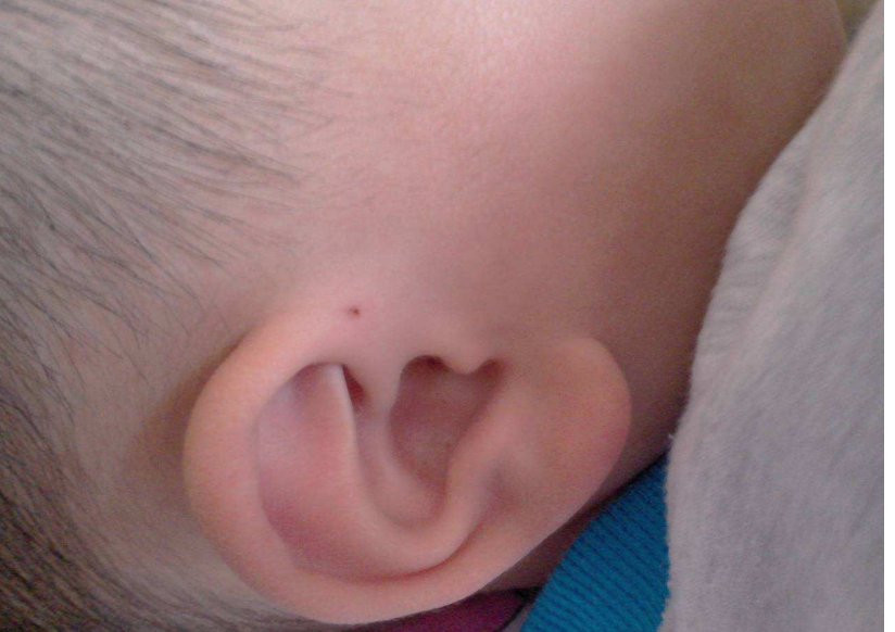 什么樣面相的寶寶有福氣 小孩子長什么樣的面相有福氣 什么樣面相的寶寶有福氣 小孩子長什么樣的面相有福氣