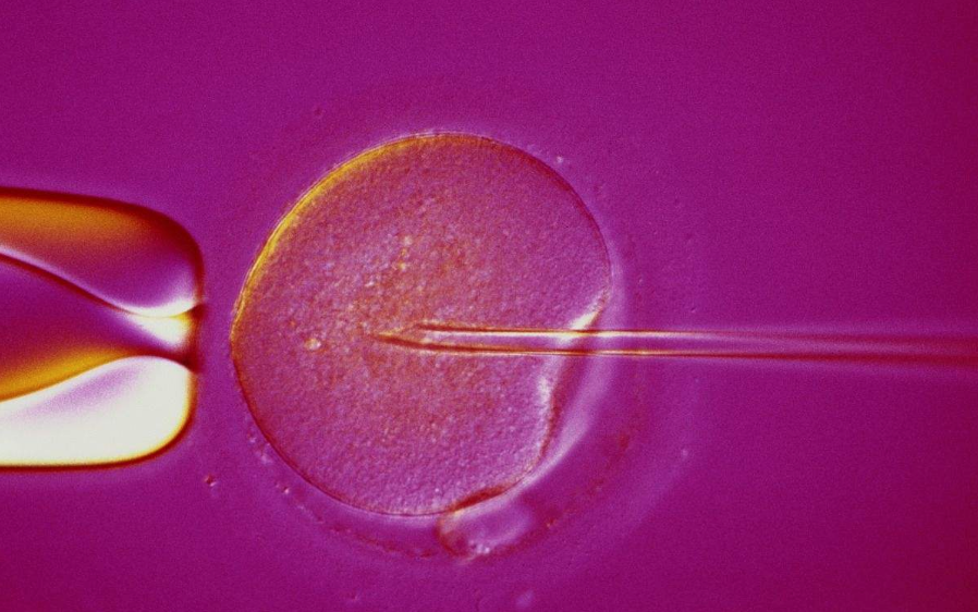 人工輔助生殖技術有哪些 怎樣正確選擇人工輔助生殖技術