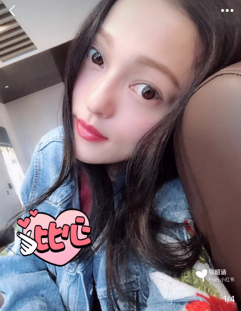 張韶涵推薦的益生菌有用嗎 女性服用益生菌有哪些好處