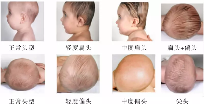 孩子枕頭怎么選好 2018怎么選擇睡出好的頭型的枕頭