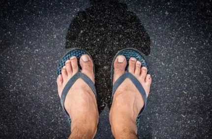 孕婦夏天能穿人字拖嗎 孕婦經常穿人字拖有什么影響