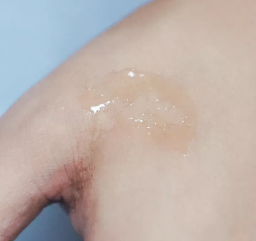 fracora胎盤素精華原液能祛斑嗎 fracora胎盤素精華原液效果好不好 fracora胎盤素精華原液能祛斑嗎 fracora胎盤素精華原液效果好不好