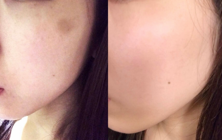 fracora胎盤素精華原液能祛斑嗎 fracora胎盤素精華原液效果好不好 fracora胎盤素精華原液能祛斑嗎 fracora胎盤素精華原液效果好不好