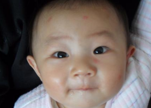 日本和光堂驅蚊貼寶有效果嗎 日本和光堂驅蚊貼寶寶用安全嗎