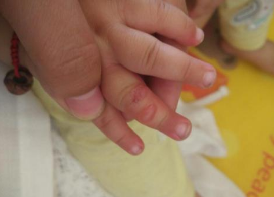 日本和光堂驅蚊胺啫喱怎么樣 日本和光堂驅蚊胺啫喱寶寶用安全嗎 日本和光堂驅蚊胺啫喱怎么樣 日本和光堂驅蚊胺啫喱寶寶用安全嗎