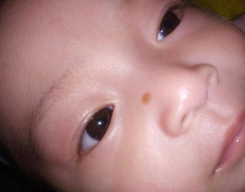 雷達(dá)OFF驅(qū)蚊液寶寶能用嗎 雷達(dá)OFF驅(qū)蚊液寶寶用安全嗎