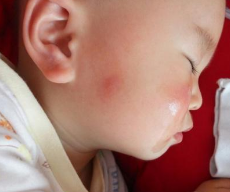 澳洲Aerogard驅蚊噴霧寶寶能用嗎 澳洲Aerogard驅蚊噴霧寶寶用安全嗎