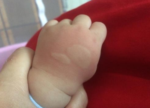 六神驅(qū)蚊花露水多大寶寶能用 寶寶用六神驅(qū)蚊花露水安全嗎