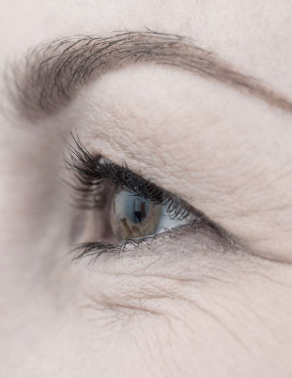 什么人容易有魚(yú)尾紋 人的魚(yú)尾紋是怎么形成的2018 什么人容易有魚(yú)尾紋 人的魚(yú)尾紋是怎么形成的2018