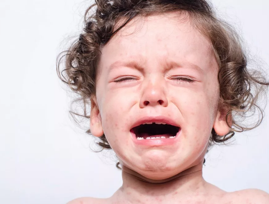 寶寶手足口嘴巴泡幾天能好 一般5—7天可以好