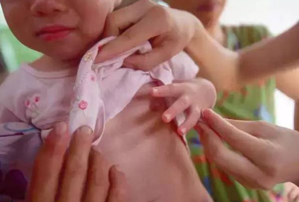 孩子吃那些東西會導致性早熟 導致孩子性早熟食物一覽2018 孩子吃那些東西會導致性早熟 導致孩子性早熟食物一覽2018