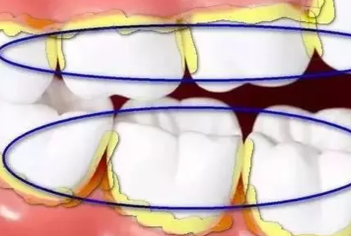 兒童電動牙刷刷頭選什么形狀 兒童電動牙刷如何挑選