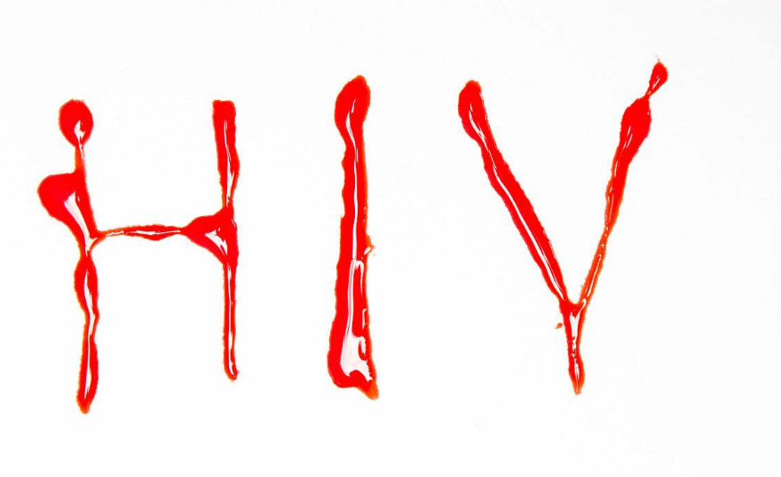 婚前體檢查出有HIV醫生會告訴男方嗎 婚前體檢查出有艾滋病需要告知另一半嗎