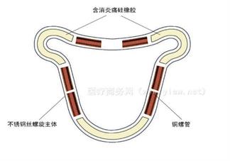 絕經(jīng)后節(jié)育環(huán)要取出來(lái)嗎 2018絕經(jīng)后癥狀調(diào)整