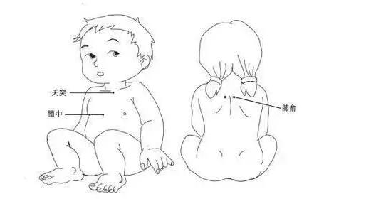 小孩貼三伏貼能治療什么2018 三伏貼對小孩有什么作用影響
